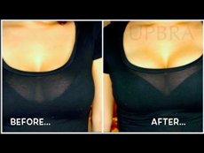 Jennifer wearing Upbra